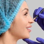 Rhinoplasty Cost Near Arlington, Virginia