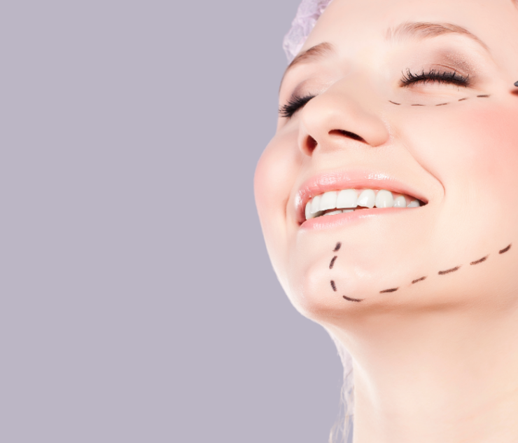 Eyelid Surgery Cost Near Vienna, VA