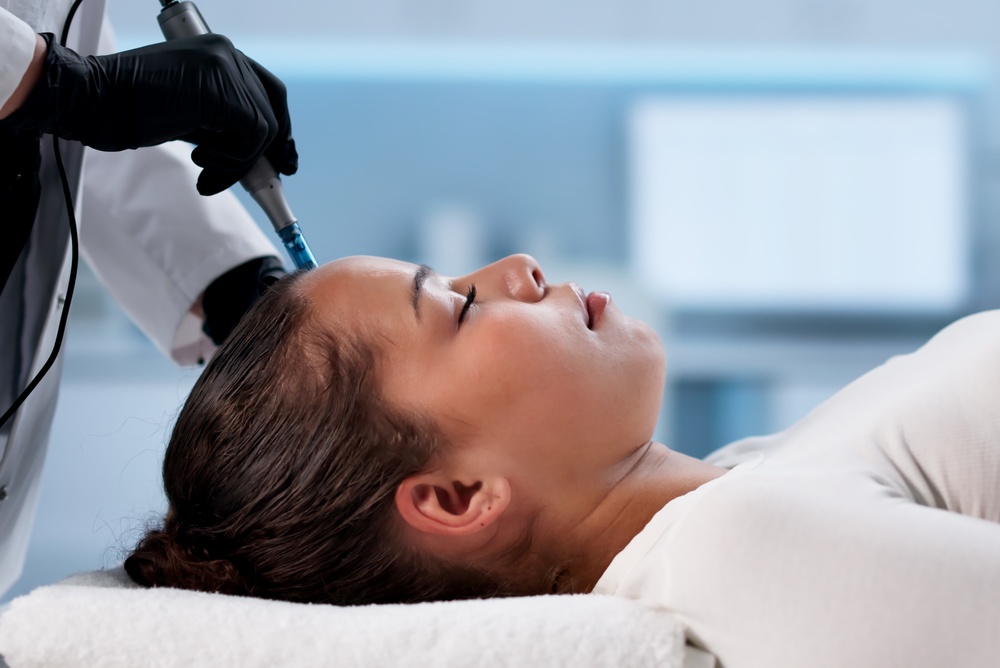 What You Need to Know About Microneedling Cost and Acne Scar Treatment in Northern Virginia