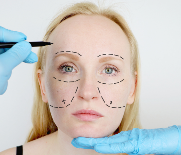 Deep Plane Facelift Cost in Fairfax, VA