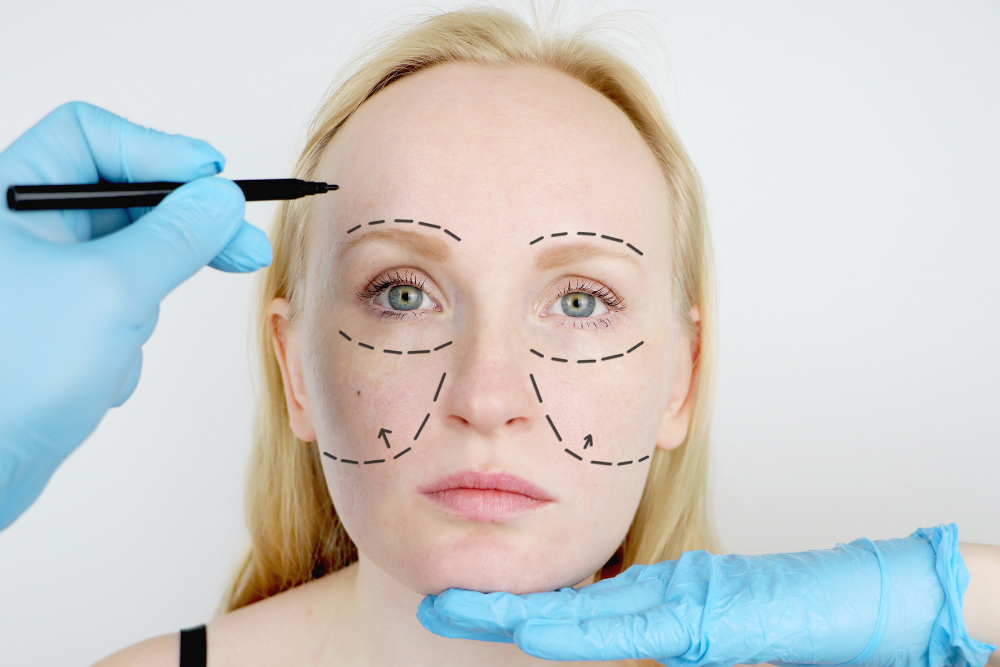 Deep Plane Facelift Cost in Fairfax, VA