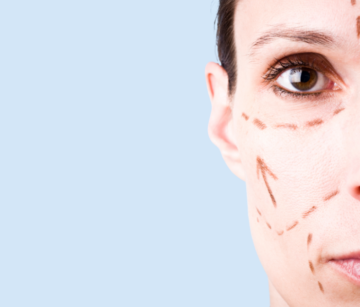 Facelift and Rhinoplasty Bundle Cost in Northern Virginia