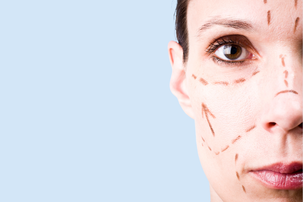 Facelift and Rhinoplasty Bundle Cost in Northern Virginia