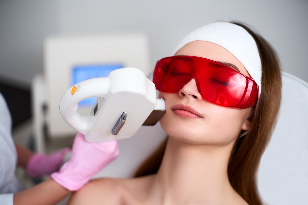 IPL Photofacial Appointment in Vienna and McLean, VA