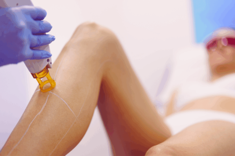 Laser Hair Removal Cost in McLean VA