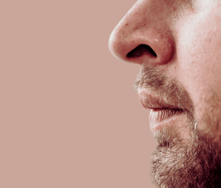 Rhinoplasty Cost in Northern Virginia