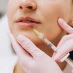 Lip Filler Near Alexandria, Virginia: Natural-Looking Lip Enhancement Consultation