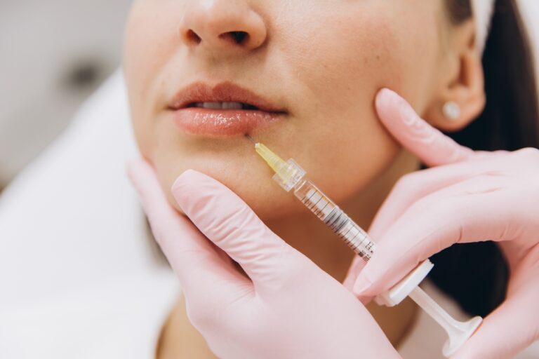 Lip Filler Near Alexandria, Virginia: Natural-Looking Lip Enhancement Consultation