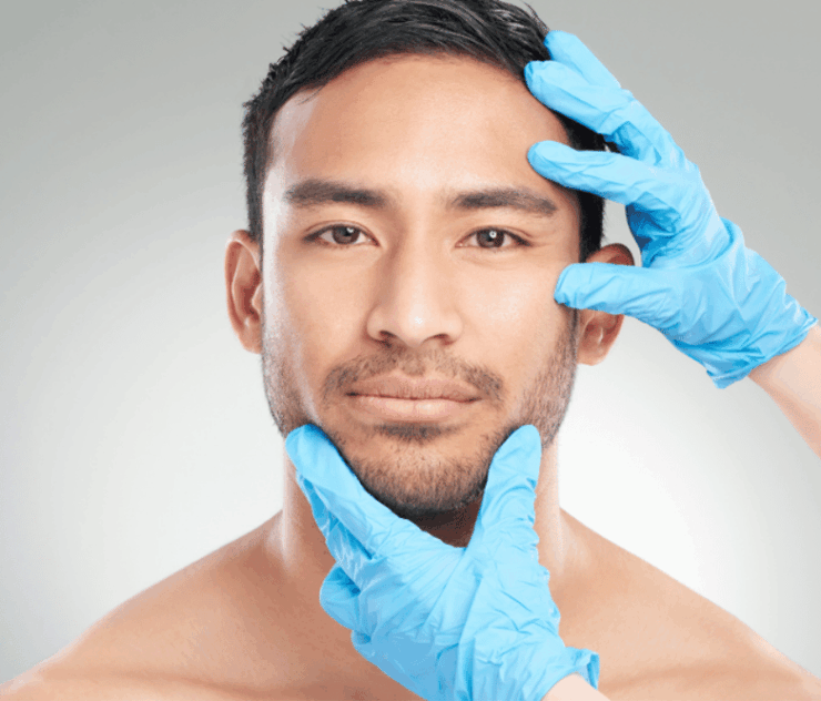 Deep Plane Facelift Near Tysons Corner Virginia