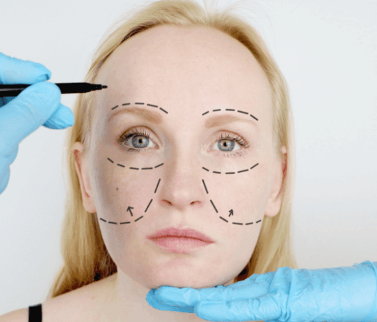 Facial Fat Transfer in Loudoun County Virginia
