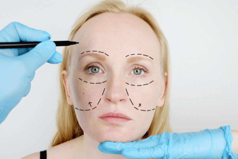 Facial Fat Transfer in Loudoun County Virginia
