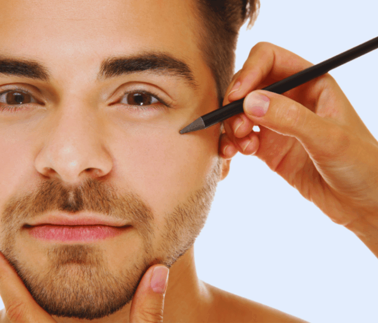 Blepharoplasty in Fairfax Virginia