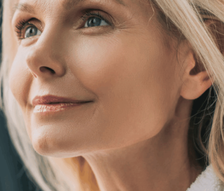Deep Plane Facelift in Alexandria VA
