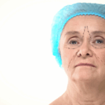 Deep Plane Facelift Specialist in Fairfax VA