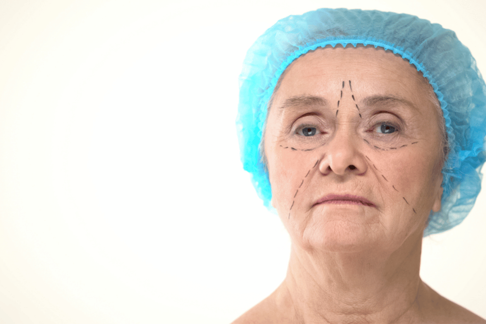 Deep Plane Facelift Specialist in Fairfax VA