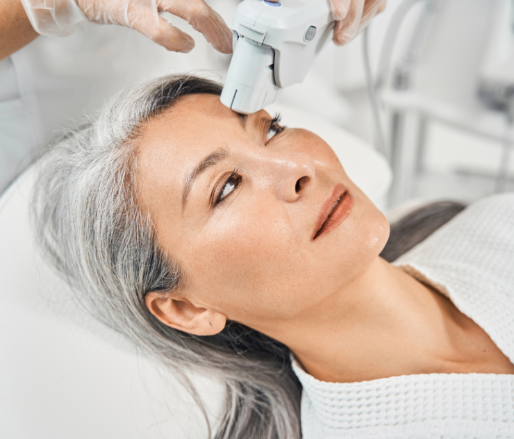 Best Anti-Aging Laser Treatments in McLean VA