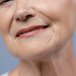 Laser Treatments for Crepey Skin Near McLean VA