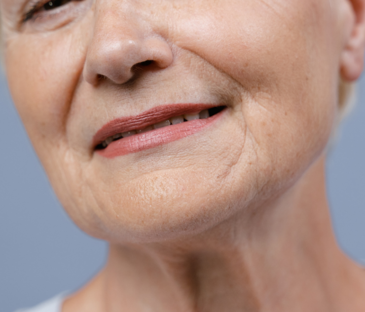 Laser Treatments for Crepey Skin Near McLean VA