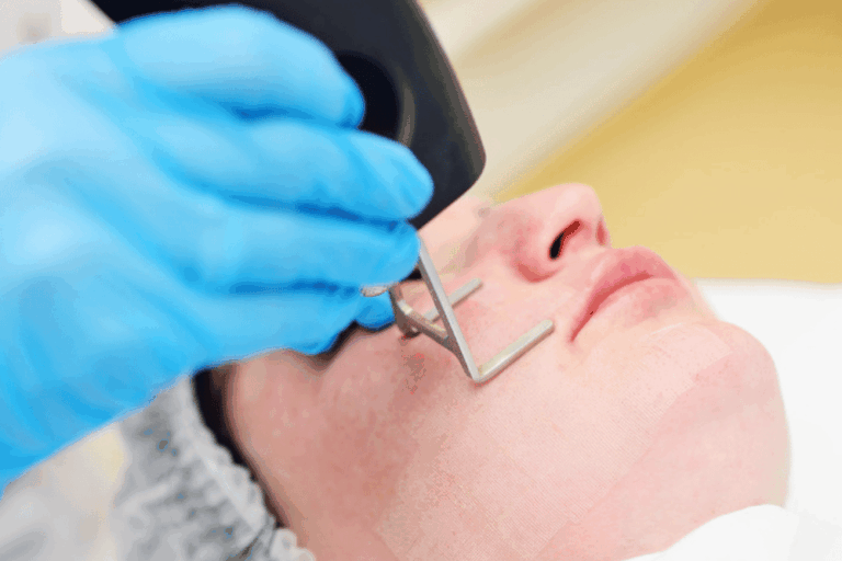 Laser Skin Tightening Near Fairfax VA