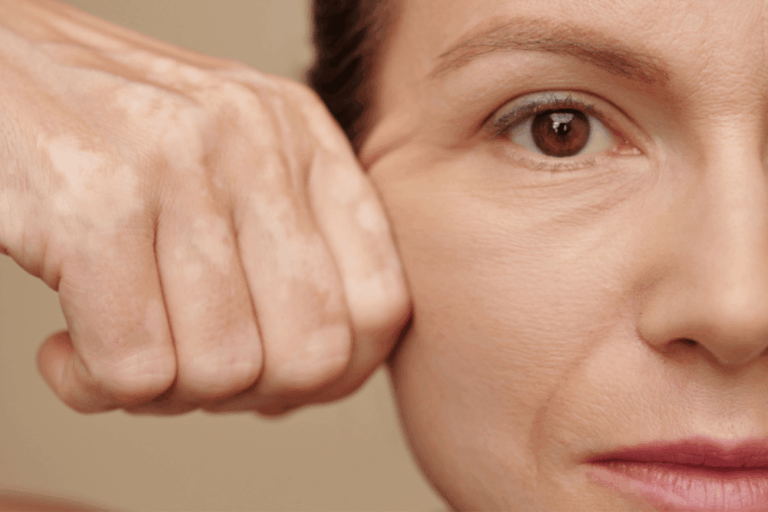 Laser Skin Tightening Pricing Near Fairfax VA