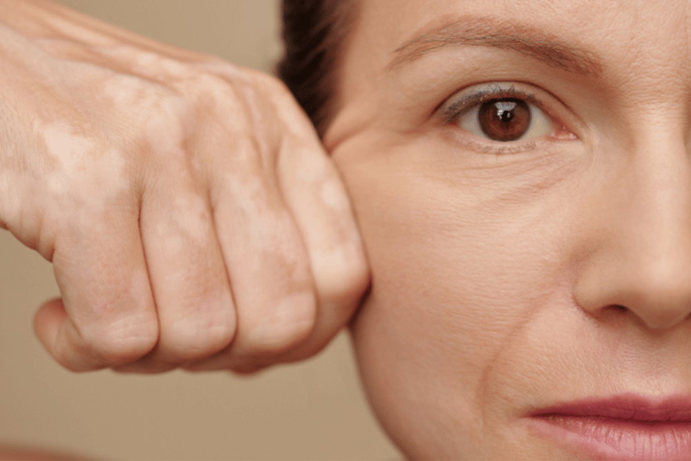 Laser Skin Tightening Pricing Near Fairfax VA