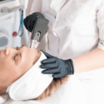 Laser Skin Tightening Near Vienna VA