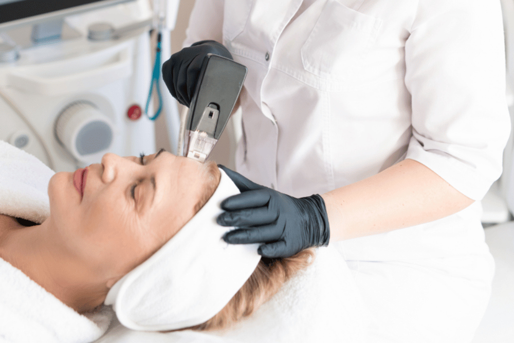 Laser Skin Tightening Near Vienna VA